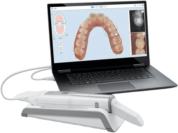 Digital Impression Kit