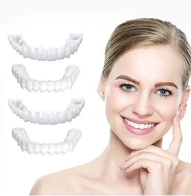 The Ultimate Guide to Snap-On Veneers: What You Need to Know