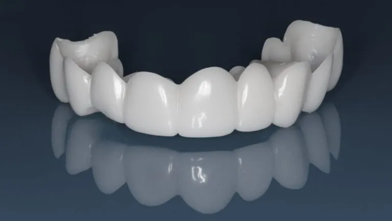 How Snap-On Veneers Can Transform Your Smile Instantly