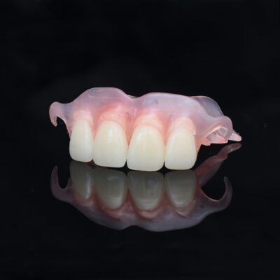 Flexible Partial Dentures
