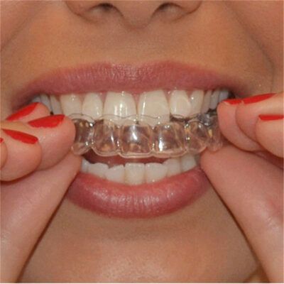 Vida Professional Teeth Whitening Kit